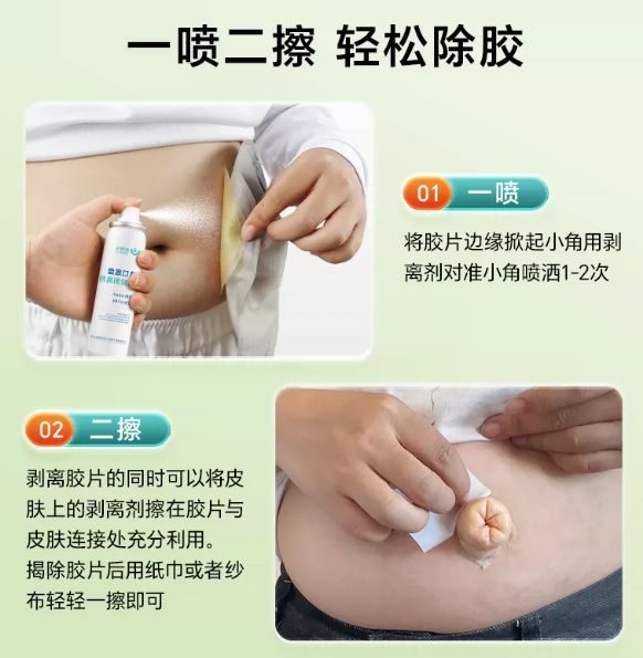 造得乐造口除胶剂医用黏胶祛除剂剥离剂造口皮肤护理用品